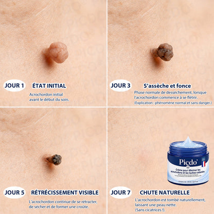 🌌𝐏𝐢𝐜𝐝𝐨® 𝐂𝐫è𝐦𝐞 𝐄𝐟𝐟𝐚𝐜𝐞𝐮𝐫 𝐝’𝐀𝐜𝐫𝐨𝐜𝐡𝐨𝐫𝐝𝐨𝐧𝐬 & 𝐝𝐞 𝐓𝐚𝐜𝐡𝐞𝐬 – 𝟕 𝐉𝐨𝐮𝐫𝐬(𝐅𝐨𝐫𝐦𝐮𝐥𝐞 𝐙é𝐫𝐨 𝐃𝐨𝐮𝐥𝐞𝐮𝐫, 𝐙é𝐫𝐨 𝐂𝐢𝐜𝐚𝐭𝐫𝐢𝐜𝐞)💥