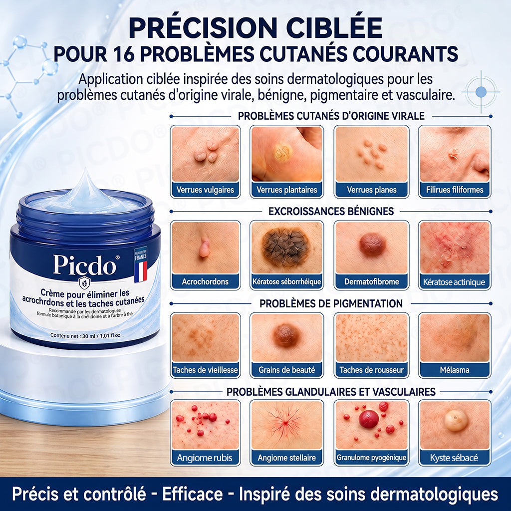 🌌𝐏𝐢𝐜𝐝𝐨® 𝐂𝐫è𝐦𝐞 𝐄𝐟𝐟𝐚𝐜𝐞𝐮𝐫 𝐝’𝐀𝐜𝐫𝐨𝐜𝐡𝐨𝐫𝐝𝐨𝐧𝐬 & 𝐝𝐞 𝐓𝐚𝐜𝐡𝐞𝐬 – 𝟕 𝐉𝐨𝐮𝐫𝐬(𝐅𝐨𝐫𝐦𝐮𝐥𝐞 𝐙é𝐫𝐨 𝐃𝐨𝐮𝐥𝐞𝐮𝐫, 𝐙é𝐫𝐨 𝐂𝐢𝐜𝐚𝐭𝐫𝐢𝐜𝐞)💥