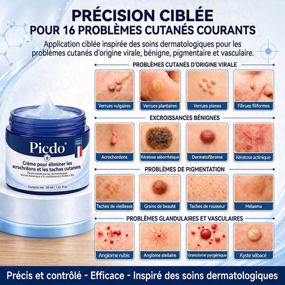 🌌𝐏𝐢𝐜𝐝𝐨® 𝐂𝐫è𝐦𝐞 𝐄𝐟𝐟𝐚𝐜𝐞𝐮𝐫 𝐝’𝐀𝐜𝐫𝐨𝐜𝐡𝐨𝐫𝐝𝐨𝐧𝐬 & 𝐝𝐞 𝐓𝐚𝐜𝐡𝐞𝐬 – 𝟕 𝐉𝐨𝐮𝐫𝐬(𝐅𝐨𝐫𝐦𝐮𝐥𝐞 𝐙é𝐫𝐨 𝐃𝐨𝐮𝐥𝐞𝐮𝐫, 𝐙é𝐫𝐨 𝐂𝐢𝐜𝐚𝐭𝐫𝐢𝐜𝐞)💥