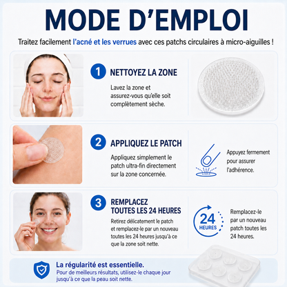 👩‍⚕️💎 𝐵𝑜𝑢𝑡𝑖𝑞𝑢𝑒 𝑂𝑓𝑓𝑖𝑐𝑖𝑒𝑙𝑙𝑒 | 𝑵𝐞𝒌𝐢𝐬𝐬® 🌿𝑴𝒊𝒄𝒓𝒐𝒏𝒆𝒆𝒅𝒍𝒆𝒔 𝑷𝒆𝒂𝒖 𝑷𝒂𝒓𝒇𝒂𝒊𝒕𝒆 É𝒍𝒊𝒎𝒊𝒏𝒂𝒕𝒊𝒐𝒏 𝑫𝒆𝒔 𝑽𝒆𝒓𝒓𝒖𝒆𝒔 𝑷𝒂𝒕𝒄𝒉 (𝑃𝑜𝑢𝑟 𝑙𝑒𝑠 𝑎𝑐𝑟𝑜𝑐ℎ𝑜𝑟𝑑𝑜𝑛𝑠, 𝑙𝑒𝑠 𝑝𝑒𝑡𝑖𝑡𝑒𝑠 𝑒𝑥𝑐𝑟𝑜𝑖𝑠𝑠𝑎𝑛𝑐𝑒𝑠 𝑐𝑢𝑡𝑎𝑛é𝑒𝑠, 𝑙𝑒𝑠 𝑣𝑒𝑟𝑟𝑢𝑒𝑠, 𝑙𝑒𝑠 𝑔𝑟𝑎𝑖𝑛𝑠 𝑑𝑒 𝑏𝑒𝑎𝑢𝑡é, 𝑙𝑒𝑠 𝑡𝑎𝑐ℎ𝑒𝑠 𝑑𝑒 𝑣𝑖𝑒𝑖𝑙𝑙𝑒𝑠𝑠𝑒 𝑒𝑡 𝑙𝑒𝑠 𝑝𝑟𝑜𝑏𝑙è𝑚𝑒𝑠 𝑑𝑒 𝑝𝑖𝑔𝑚𝑒𝑛𝑡𝑎𝑡𝑖𝑜𝑛)